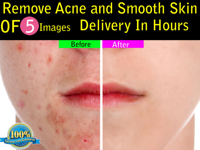 I will remove acne from photo and smooth skin