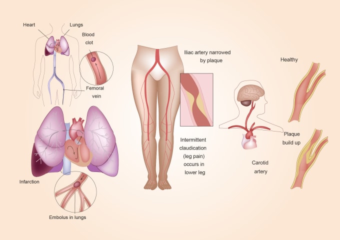 I will draw a professional anatomical medical drawing