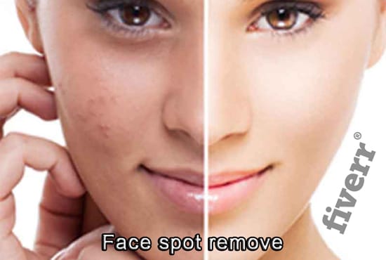 I will remove spot and pimples in photoshop with 24 hrs