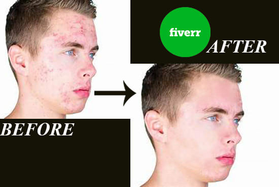 I will best online photo editor and skin retouching