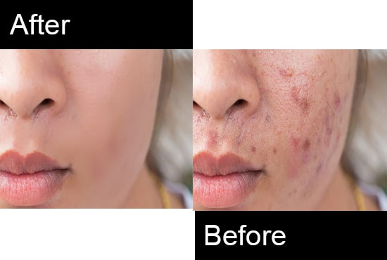 I will do best and realistic skin retouching