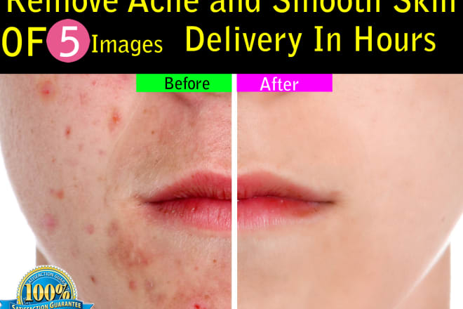 I will remove acne from photo and smooth skin