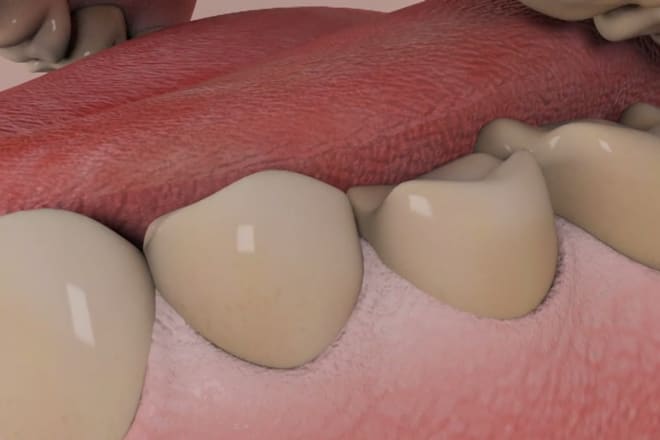 I will 3d animation about the dental process