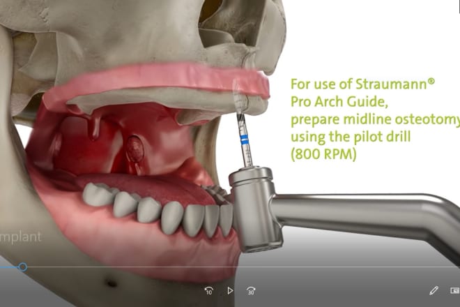 I will dental and medical 3d animated videos