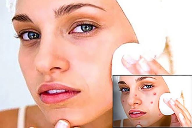 I will remove pimples or unwanted hair from your face plus retouch