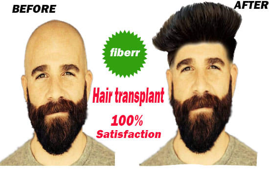 I will do hair transplant, haircut change on the bald head