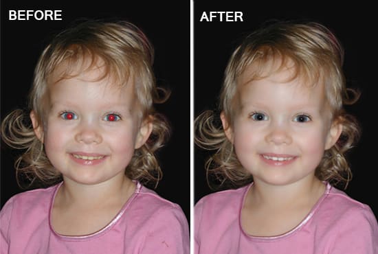 I will red eye removal, skin retouching and teeth whitening